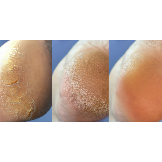 NAILSOFTHEDAY Podology Crema contra grietas