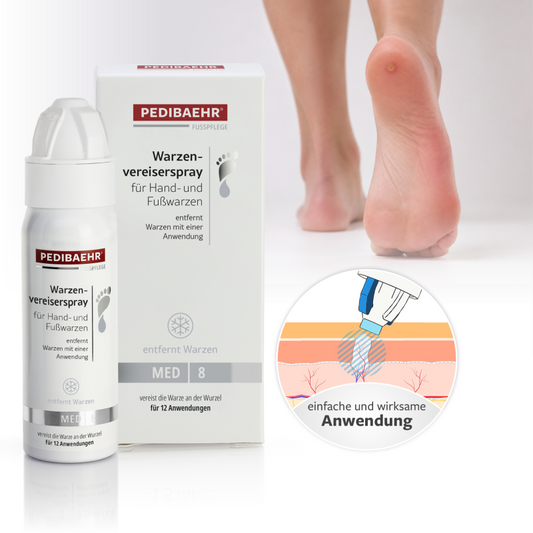 Wart freezer spray for hands and feet