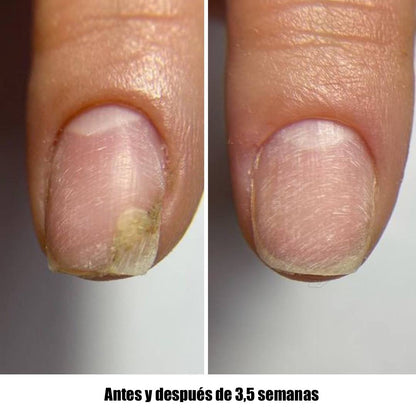 NAILSOFTHEDAY ONISTOP