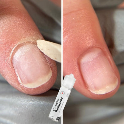 NAILSOFTHEDAY Cuticle Remover