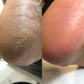 NAILSOFTHEDAY Podiatry Keratolytic for feet