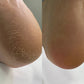 NAILSOFTHEDAY Podiatry Keratolytic for feet